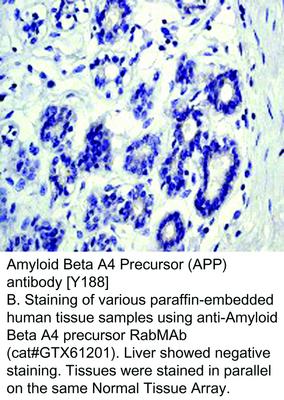 Amyloid Beta A4 Precursor (APP) antibody [Y188], GeneTex