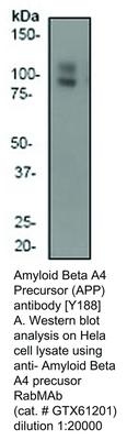 Amyloid Beta A4 Precursor (APP) antibody [Y188], GeneTex