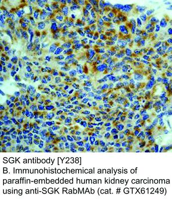 SGK antibody [Y238], GeneTex