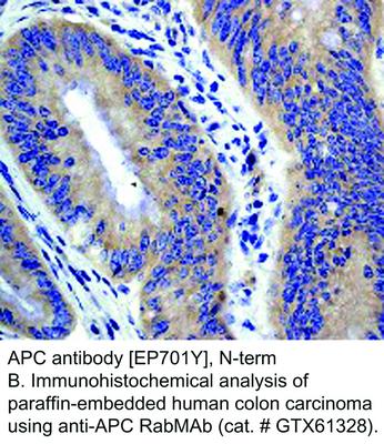 APC antibody [EP701Y], N-term, GeneTex