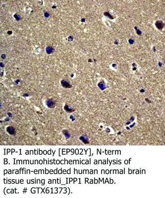 IPP-1 antibody [EP902Y], N-term, GeneTex