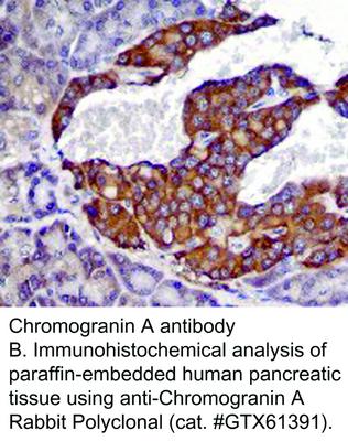 RB PAB TO CHROMOGRANIN A