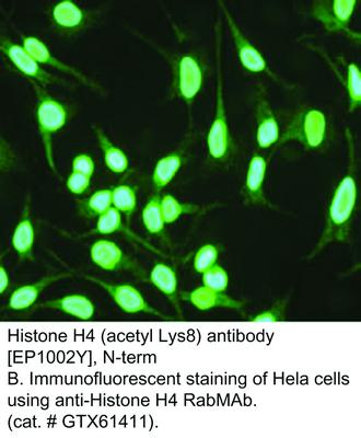 RB MAB TO HISTONE H4 ACETYL K8