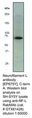 RB MAB TO NEUROFILAMENT L