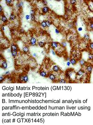 Golgi Matrix Protein (GM130) antibody [EP892Y], GeneTex