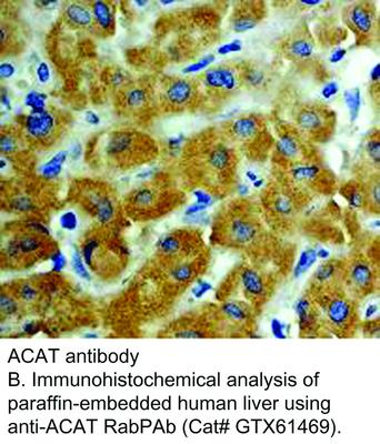 ACAT antibody, GeneTex