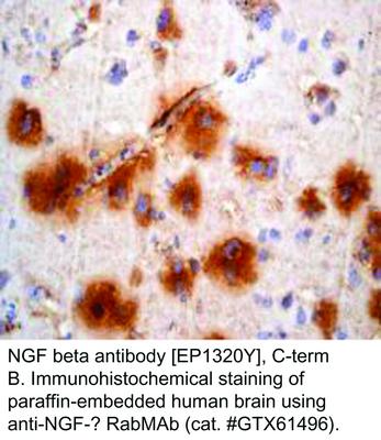 NGF beta antibody [EP1320Y], C-term, GeneTex