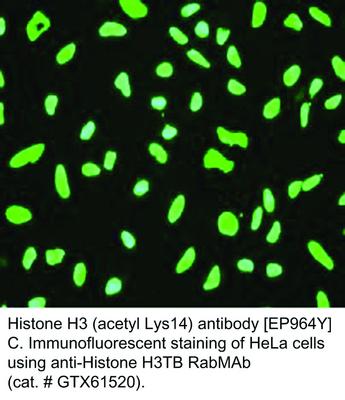 RB MAB TO HISTONE H3 AC K14