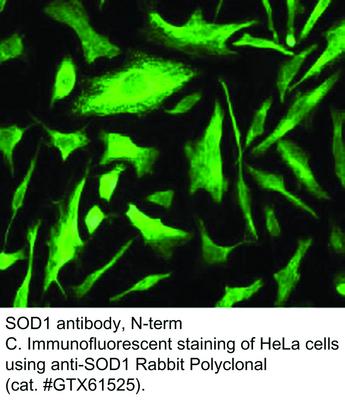 SOD1 antibody, N-term, GeneTex