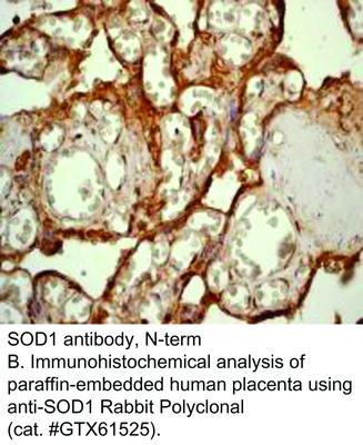 SOD1 antibody, N-term, GeneTex