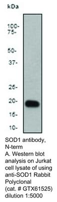 SOD1 antibody, N-term, GeneTex