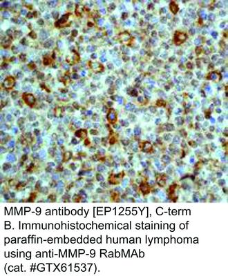 MMP-9 antibody [EP1255Y], C-term, GeneTex