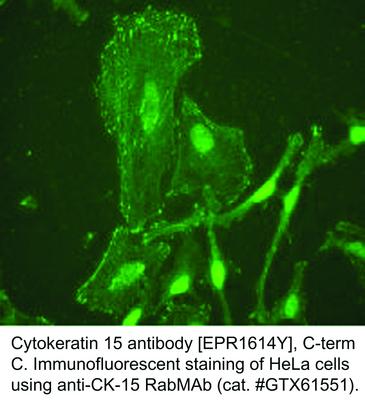 Cytokeratin 15 antibody [EPR1614Y], C-term, GeneTex