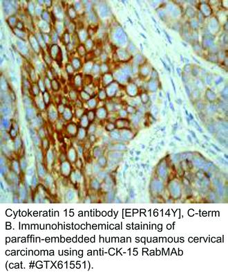 Cytokeratin 15 antibody [EPR1614Y], C-term, GeneTex