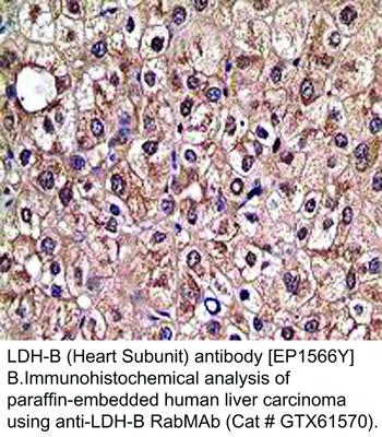 LDH-B (Heart Subunit) antibody [EP1566Y], GeneTex