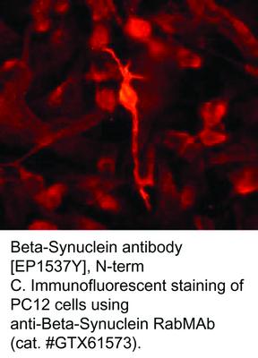 RB MAB TO BETA-SYNUCLEIN