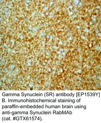 Gamma Synuclein (SR) antibody [EP1539Y], GeneTex