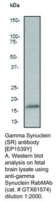 Gamma Synuclein (SR) antibody [EP1539Y], GeneTex