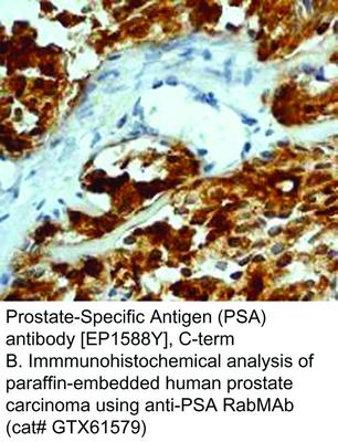 Prostate-Specific Antigen (PSA) antibody [EP1588Y], C-term, GeneTex