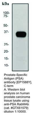 Prostate-Specific Antigen (PSA) antibody [EP1588Y], C-term, GeneTex