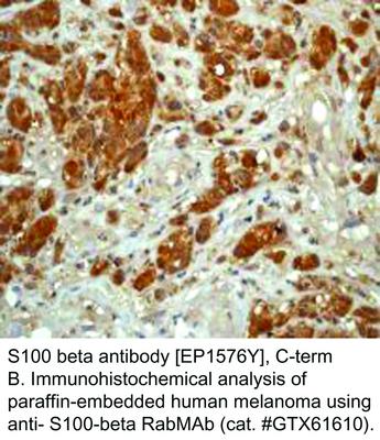 S100 beta antibody [EP1576Y], C-term, GeneTex