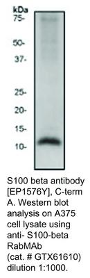 S100 beta antibody [EP1576Y], C-term, GeneTex