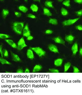 SOD1 antibody [EP1727Y], GeneTex