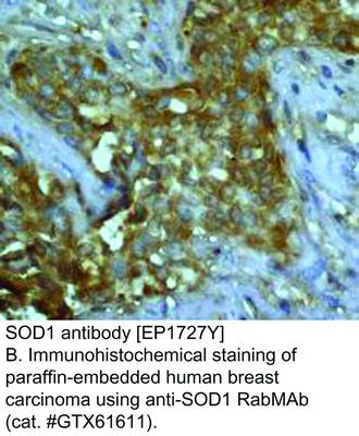 SOD1 antibody [EP1727Y], GeneTex