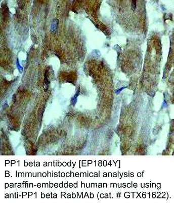 PP1 beta antibody [EP1804Y], GeneTex