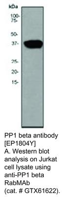 PP1 beta antibody [EP1804Y], GeneTex