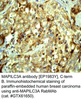 MAPILC3A antibody [EP1983Y], C-term, GeneTex