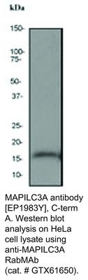 MAPILC3A antibody [EP1983Y], C-term, GeneTex