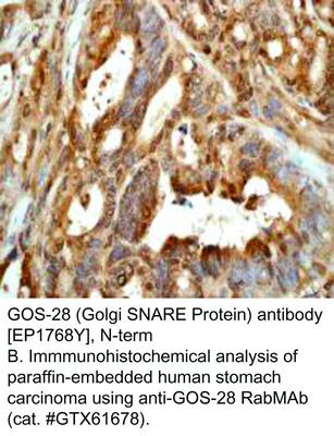 GOS-28 (Golgi SNARE Protein) antibody [EP1768Y], N-term, GeneTex