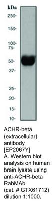 RB MAB TO ACHR-B EXTRACELLULAR