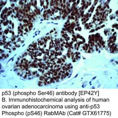 p53 (phospho Ser46) antibody [EP42Y], GeneTex