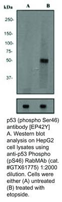 p53 (phospho Ser46) antibody [EP42Y], GeneTex