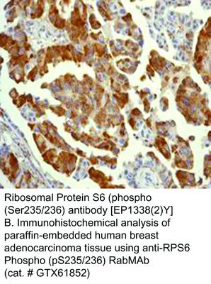 Ribosomal Protein S6 (phospho (Ser235/236) antibody [EP1338(2)Y], GeneTex