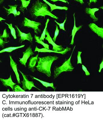 Cytokeratin 7 antibody [EPR1619Y], GeneTex