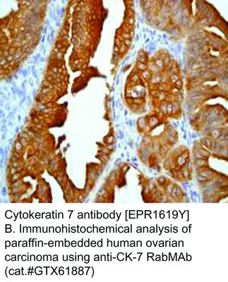 Cytokeratin 7 antibody [EPR1619Y], GeneTex