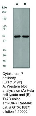 Cytokeratin 7 antibody [EPR1619Y], GeneTex