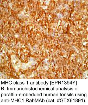 MHC class 1 antibody [EPR1394Y], GeneTex