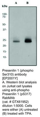 RB MAB TO PRESENILIN 1 (PS310)