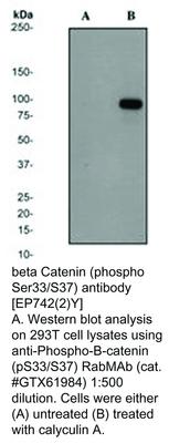 beta Catenin (phospho Ser33/S37) antibody [EP742(2)Y], GeneTex