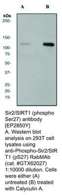 RB MAB TO SIR2/SIRT1 (PS27)