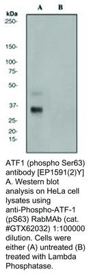 ATF1 (phospho Ser63) antibody [EP1591(2)Y], GeneTex