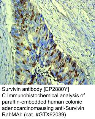 Survivin antibody [EP2880Y], GeneTex