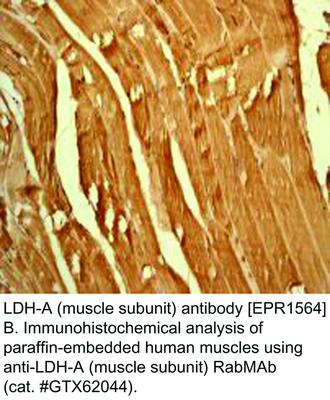 RB MAB TO LDH-A MUSCLE SUBUNIT