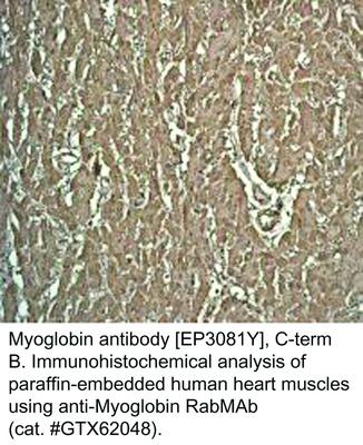 Myoglobin antibody [EP3081Y], C-term, GeneTex