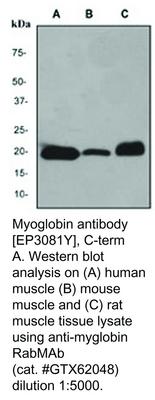 Myoglobin antibody [EP3081Y], C-term, GeneTex