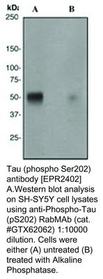 Tau (phospho Ser202) antibody [EPR2402], GeneTex